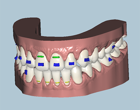 Placeholder Picture