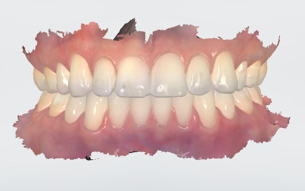 Placeholder Picture