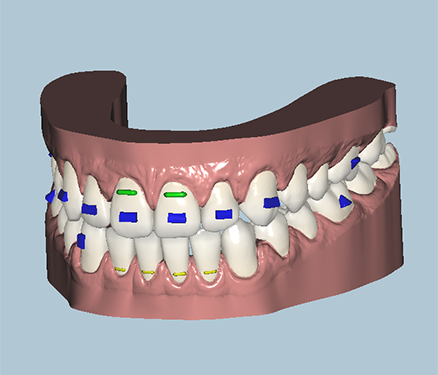 Placeholder Picture