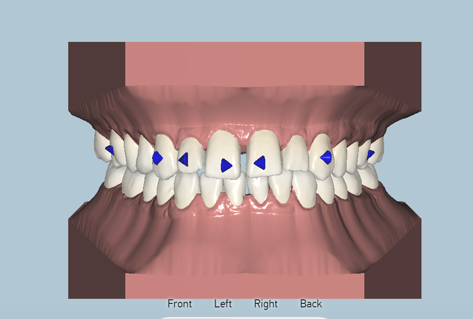 Placeholder Picture