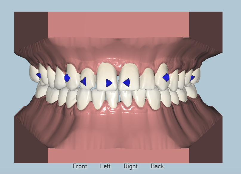 Placeholder Picture