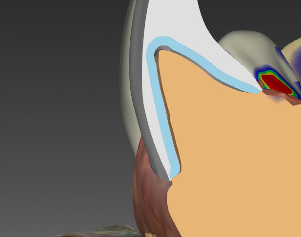 Placeholder Picture