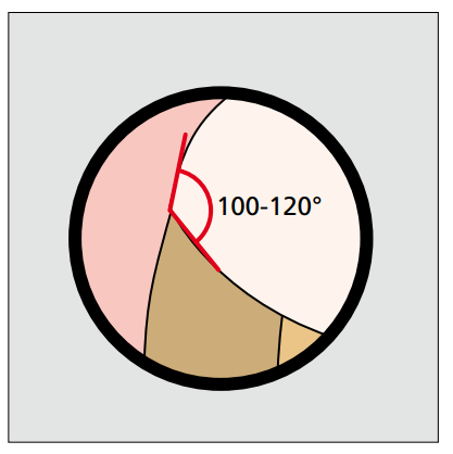Placeholder Picture
